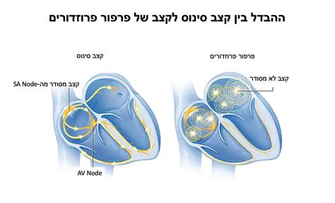 lvef מה זה
